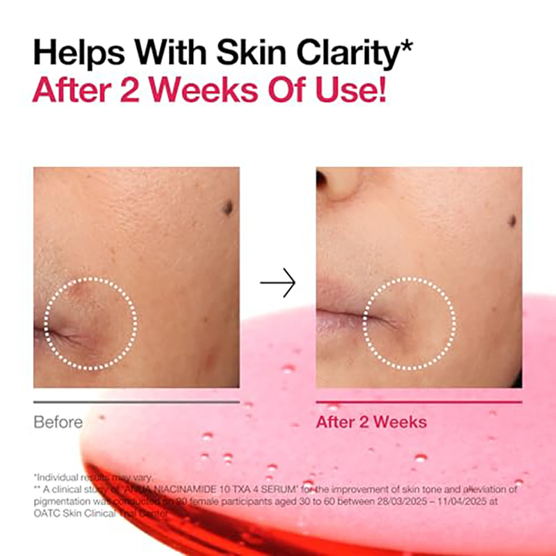 Anua Niacinamide 10 + TXA 4 Serum, Pflege bei dunklen Flecken, Hyaluronsäure, Tranexamsäure, Leichtes & hydratisierendes All-in-One Daily Serum für Glass Skin, Korean Skincare, 30ml - Image 6