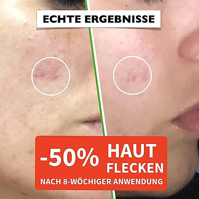 60ml Bio Hyaluron Serum mit Vitamin C, E. Hochkonzentriert Anti-Falten, Anti-Aging & Dunkle-Flecken. Hyaluronsäure-Gesichtsserum, Ideal als Augenkonturcreme. Dermaroller Essence. Vegane Naturkosmetik - Image 4
