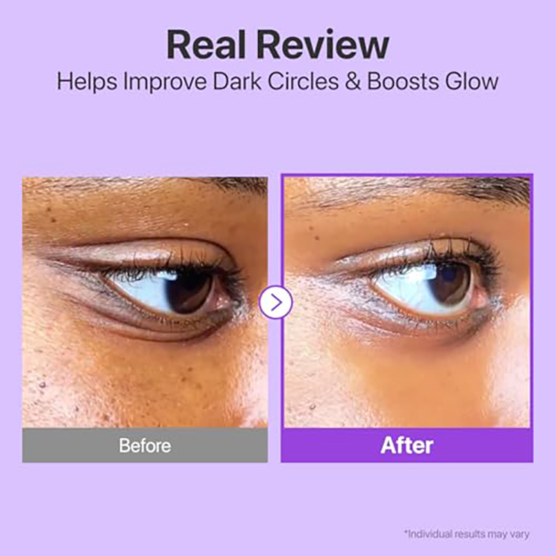 numbuzin No.9 Eye Cream | NAD+ Retinol Volumetox Eye Cream | Firming, Wrinkles, Fine Lines, Dark Circles, Puffy | Retinol, Peptides, Niacinamide | Undereye Treatment Serum | 0.33 fl. oz. - Image 4