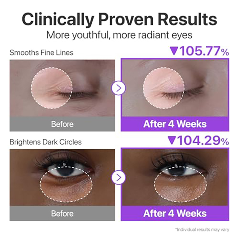 numbuzin No.9 Eye Cream | NAD+ Retinol Volumetox Eye Cream | Firming, Wrinkles, Fine Lines, Dark Circles, Puffy | Retinol, Peptides, Niacinamide | Undereye Treatment Serum | 0.33 fl. oz. - Image 3