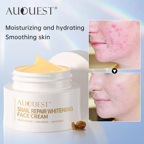 Snail essence cream: hydration, shine, and acne treatment.